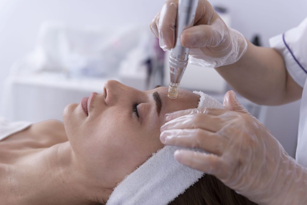 Aesthetician performing microneedling on womans face